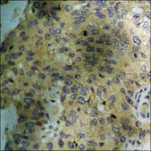 抗-磷酸化-AMPK &#945; (pThr172) 兔抗 affinity isolated antibody