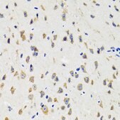 Anti-IKBKG antibody produced in rabbit