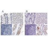 Anti-ZPBP2 antibody produced in rabbit Prestige Antibodies® Powered by Atlas Antibodies, affinity isolated antibody, buffered aqueous glycerol solution