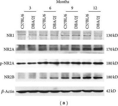 Anti-NR2B Antibody Upstate&#174;, from rabbit