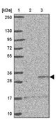 Anti-ST8SIA2 antibody produced in rabbit Prestige Antibodies&#174; Powered by Atlas Antibodies, affinity isolated antibody, buffered aqueous glycerol solution