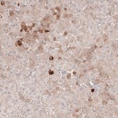 Monoclonal Anti-SAA1 antibody produced in mouse Prestige Antibodies&#174; Powered by Atlas Antibodies, clone CL9175, purified immunoglobulin, buffered aqueous glycerol solution