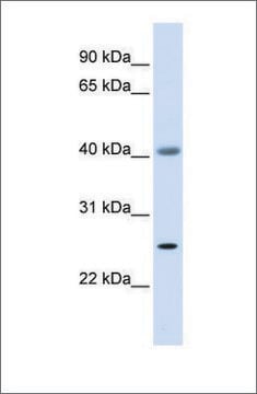Anti-ADA antibody produced in rabbit affinity isolated antibody