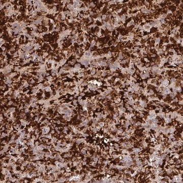 Anti-BLVRA antibody produced in rabbit Prestige Antibodies&#174; Powered by Atlas Antibodies, affinity isolated antibody, buffered aqueous glycerol solution