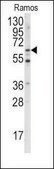 Anti-MEN1 (S128) antibody produced in rabbit saturated ammonium sulfate (SAS) precipitated, buffered aqueous solution