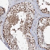 Anti-PLRG1 antibody produced in rabbit Prestige Antibodies&#174; Powered by Atlas Antibodies, affinity isolated antibody, buffered aqueous glycerol solution