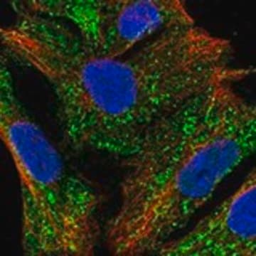 Anti-METTL27 antibody produced in rabbit Prestige Antibodies&#174; Powered by Atlas Antibodies, affinity isolated antibody, buffered aqueous glycerol solution