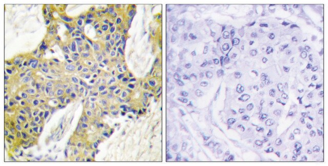 Anti-IARS2 antibody produced in rabbit affinity isolated antibody