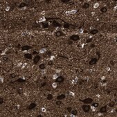 Anti-PDP1 antibody produced in rabbit Prestige Antibodies® Powered by Atlas Antibodies, affinity isolated antibody, buffered aqueous glycerol solution