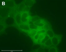 Anti-MEK1 Antibody, clone 1F18 ZooMAb® Rabbit Monoclonal recombinant, expressed in HEK 293 cells