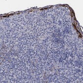 Anti-ATP12A antibody produced in rabbit Prestige Antibodies® Powered by Atlas Antibodies, affinity isolated antibody, buffered aqueous glycerol solution