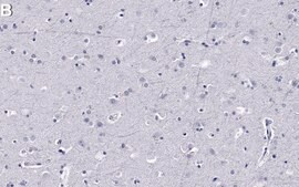 Anti-IFNAR2 Antibody, clone 1M16 ZooMAb&#174; Rabbit Monoclonal recombinant, expressed in HEK 293 cells