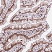 抗-LBR 兔抗 Prestige Antibodies&#174; Powered by Atlas Antibodies, affinity isolated antibody, buffered aqueous glycerol solution