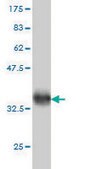 Monoclonal Anti-ZNF213 antibody produced in mouse clone 5D7, purified immunoglobulin, buffered aqueous solution