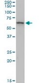 Monoclonal Anti-KRT6B antibody produced in mouse clone 1C12, purified immunoglobulin, buffered aqueous solution