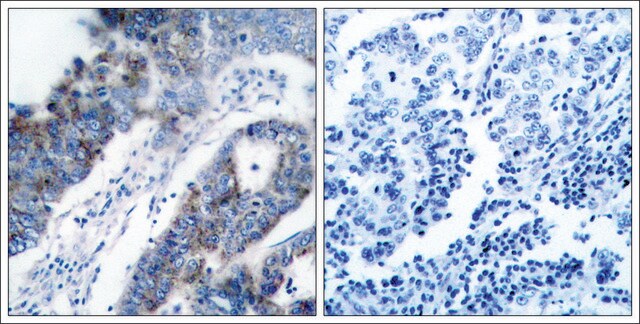 Anti-MAP3K5 (Ab-83) antibody produced in rabbit affinity isolated antibody