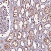 Anti-USPL1 antibody produced in rabbit Prestige Antibodies&#174; Powered by Atlas Antibodies, affinity isolated antibody, buffered aqueous glycerol solution