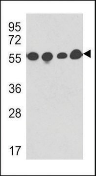MONOCLONAL ANTI-TBB5 antibody produced in mouse clone 87CT59.3.7, IgG fraction of antiserum, buffered aqueous solution