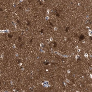 Anti-RAP1GDS1 antibody produced in rabbit affinity isolated antibody, buffered aqueous glycerol solution