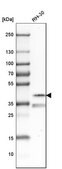 Anti-PITX3 antibody produced in rabbit Prestige Antibodies&#174; Powered by Atlas Antibodies, affinity isolated antibody, buffered aqueous glycerol solution