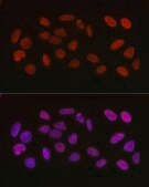 Anti- Acetyl-HMGB1-K29 antibody produced in rabbit