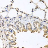 Anti-BAX antibody produced in rabbit