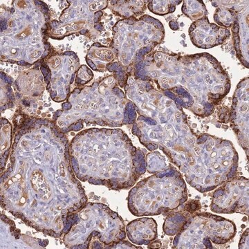 Anti-TRMO antibody produced in rabbit Prestige Antibodies&#174; Powered by Atlas Antibodies, affinity isolated antibody, buffered aqueous glycerol solution