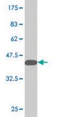 Monoclonal Anti-LMX1B, (N-terminal) antibody produced in mouse clone 1D12, purified immunoglobulin, buffered aqueous solution