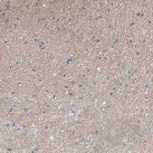 Anti-ADGRL1 antibody produced in rabbit Prestige Antibodies&#174; Powered by Atlas Antibodies, affinity isolated antibody, buffered aqueous glycerol solution