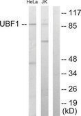 Anti-UBF1 antibody produced in rabbit affinity isolated antibody