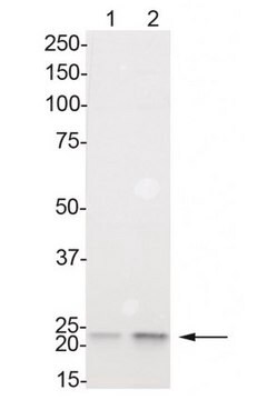 Anti-phospho-HP1 &#947; (Ser83) Antibody Upstate&#174;, from rabbit