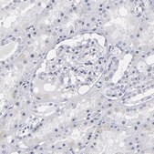 Anti-RPH3A antibody produced in rabbit Prestige Antibodies&#174; Powered by Atlas Antibodies, affinity isolated antibody, buffered aqueous glycerol solution