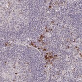 Anti-MEIS1 antibody produced in rabbit Prestige Antibodies&#174; Powered by Atlas Antibodies, affinity isolated antibody, buffered aqueous glycerol solution
