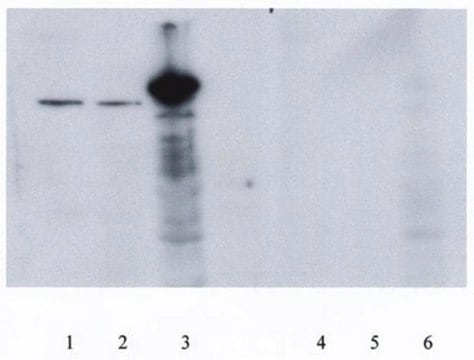 Anti-PGC-1 Antibody Chemicon&#174;, from rabbit