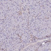 Anti-ABCA8 antibody produced in rabbit Prestige Antibodies&#174; Powered by Atlas Antibodies, affinity isolated antibody, buffered aqueous glycerol solution