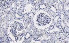 Anti-PLD2 Antibody, clone 6F13 ZooMAb® Rabbit Monoclonal recombinant, expressed in HEK 293 cells