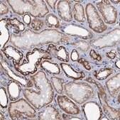 Anti-RASSF9 antibody produced in rabbit Prestige Antibodies&#174; Powered by Atlas Antibodies, affinity isolated antibody, buffered aqueous glycerol solution