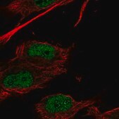 Anti-HOXC9 antibody produced in rabbit Prestige Antibodies&#174; Powered by Atlas Antibodies, affinity isolated antibody
