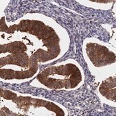 Anti-BLVRA antibody produced in rabbit Prestige Antibodies&#174; Powered by Atlas Antibodies, affinity isolated antibody, buffered aqueous glycerol solution