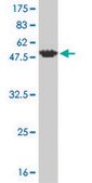 Monoclonal Anti-FCER1A antibody produced in mouse clone 2C12-3B6, purified immunoglobulin, buffered aqueous solution