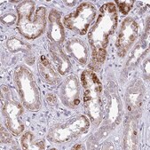 Anti-TMEM178B antibody produced in rabbit Prestige Antibodies® Powered by Atlas Antibodies, affinity isolated antibody, buffered aqueous glycerol solution