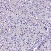 Monoclonal Anti-SLC27A5 antibody produced in mouse Prestige Antibodies&#174; Powered by Atlas Antibodies, clone CL0213, purified immunoglobulin, buffered aqueous glycerol solution