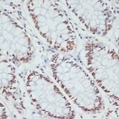 Anti-Phospho-POLR2A-S5 antibody produced in rabbit