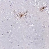 Anti-GPR17 antibody produced in rabbit Prestige Antibodies&#174; Powered by Atlas Antibodies, affinity isolated antibody, buffered aqueous glycerol solution