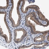 Anti-TMEM53 antibody produced in rabbit Prestige Antibodies&#174; Powered by Atlas Antibodies, affinity isolated antibody, buffered aqueous glycerol solution