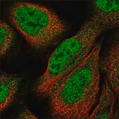 Anti-CDO1 antibody produced in rabbit Prestige Antibodies® Powered by Atlas Antibodies, affinity isolated antibody, buffered aqueous glycerol solution