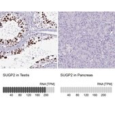 Anti-SUGP2 antibody produced in rabbit Prestige Antibodies&#174; Powered by Atlas Antibodies, affinity isolated antibody, buffered aqueous glycerol solution