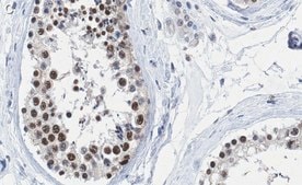 Anti-METTL14 Antibody, clone 2G22 ZooMAb® Rabbit Monoclonal recombinant, expressed in HEK 293 cells