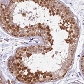 Anti-WDR61 antibody produced in rabbit Prestige Antibodies&#174; Powered by Atlas Antibodies, affinity isolated antibody, buffered aqueous glycerol solution