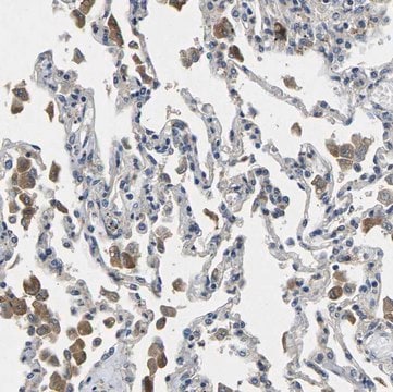 Anti-PLCE1 antibody produced in rabbit Prestige Antibodies&#174; Powered by Atlas Antibodies, affinity isolated antibody, buffered aqueous glycerol solution